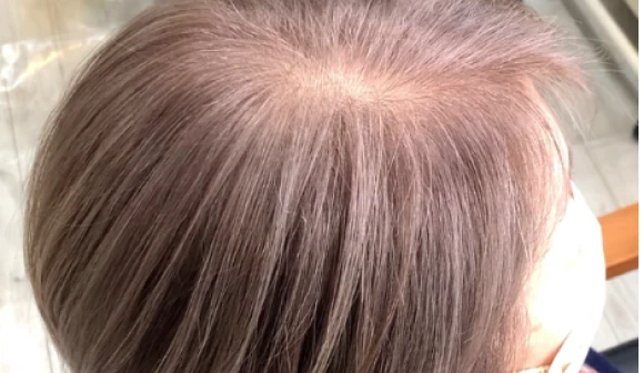白髪ぼかし