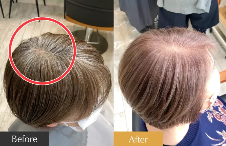 シュシュでお悩み解決